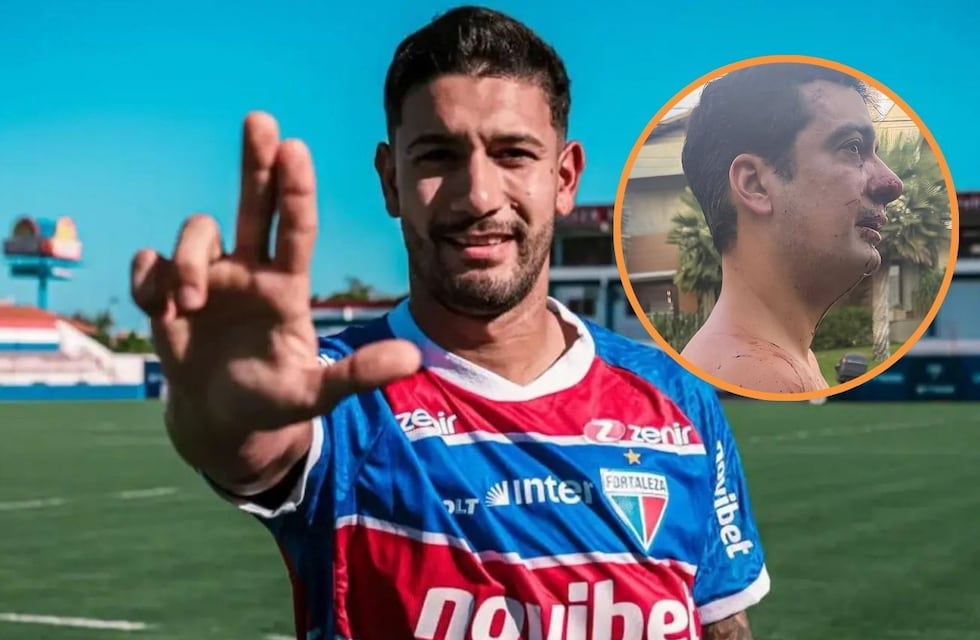 Escándalo en Brasil: un jugador argentino le habría mordido la nariz a un hombre durante una pelea vecinal