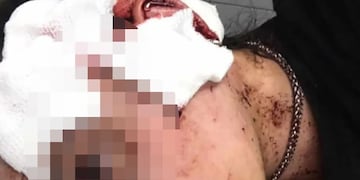 Habló Agustina Tramontana, la moza que fue agredida en un bar de la calle Arístides, Mendoza.