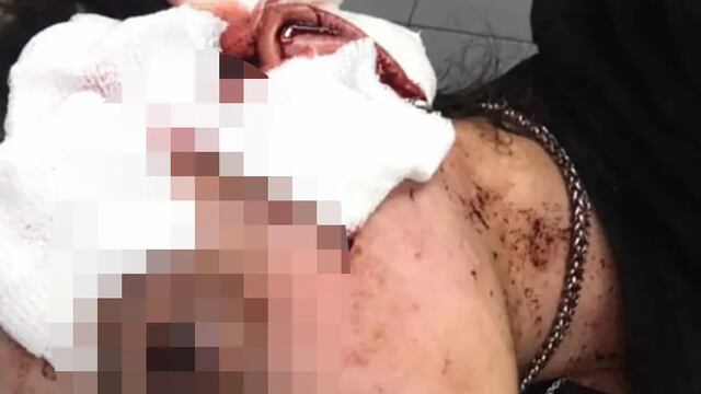 Habló Agustina Tramontana, la moza que fue agredida en un bar de la calle Arístides, Mendoza.