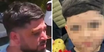 Bastian lucha por su vida y su padre está imputado por negligencia