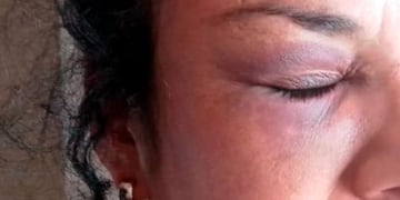 Su pareja la secuestró, golpeó y violó durante cuatro días.
