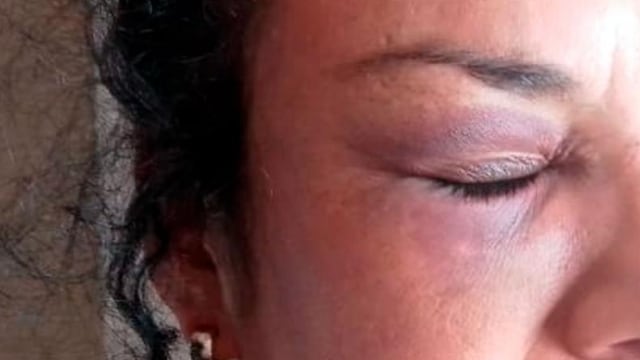 Su pareja la secuestró, golpeó y violó durante cuatro días.