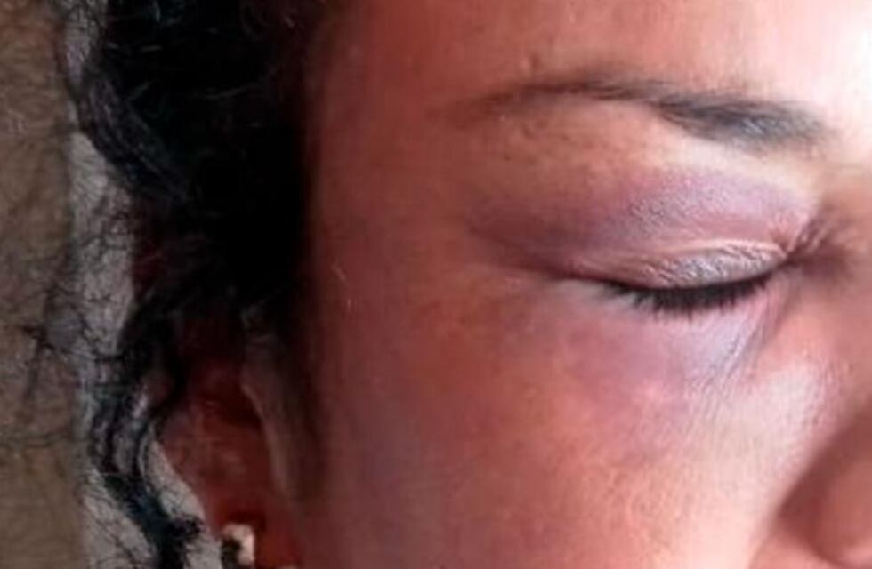 Violencia de género en barrio Ameghino Norte: la secuestró y violó durante cuatro días