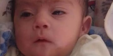 Tobías Valentino Viscarra, el bebé de tres meses que necesita acceder a un tratamiento médico por problemas en el corazón.