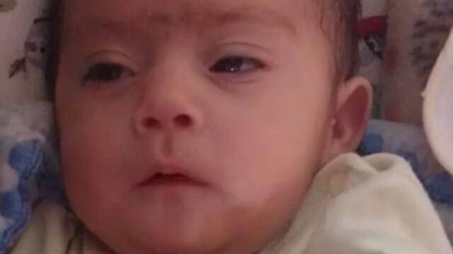 Tobías Valentino Viscarra, el bebé de tres meses que necesita acceder a un tratamiento médico por problemas en el corazón.