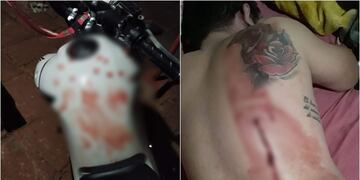 IMÁGENES SENSIBLES|Vecino corrió a tiros a jóvenes que hacían ruido con sus motos