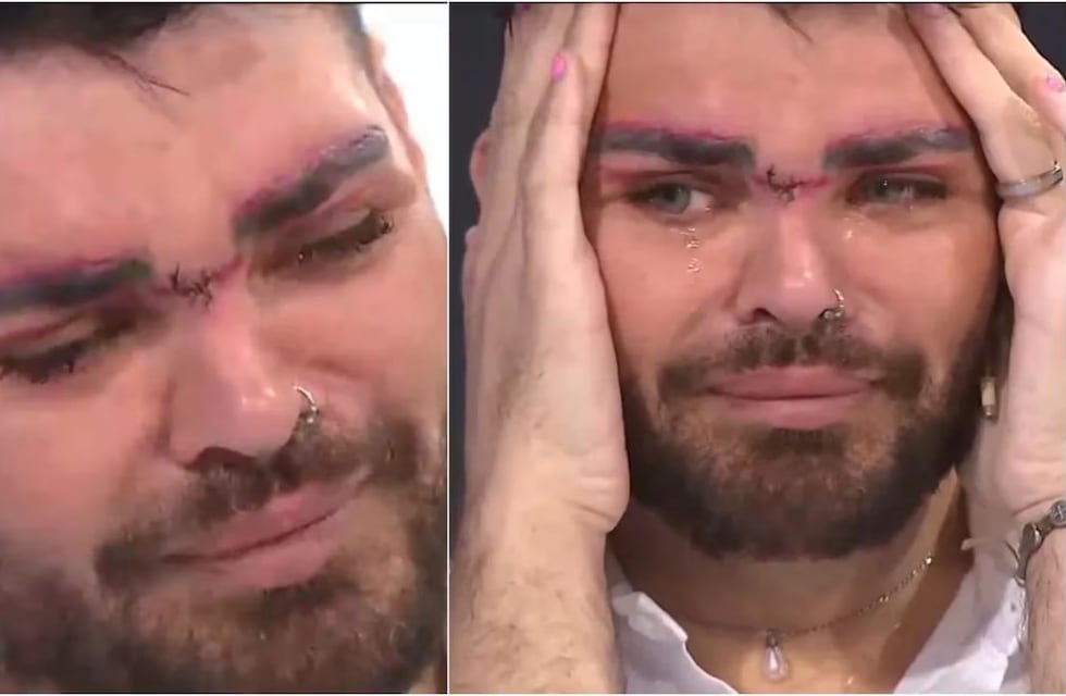 El desconsolado llanto de Fran Mariano al hablar de la mala praxis que le hizo Aníbal Lotocki: “Me desfiguró”