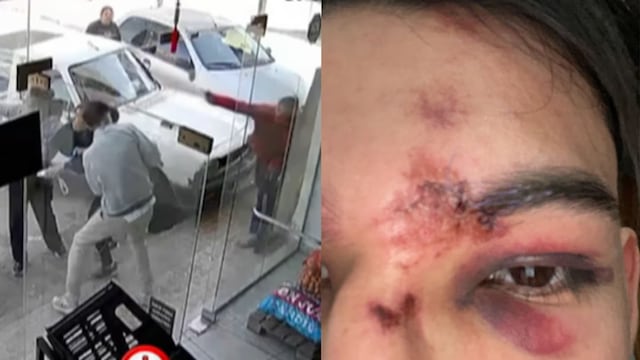 Violenta agresión tras accidente de tránsito en Villa Carlos Paz