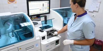 La jefa del Servicio del Laboratorio, Silvia Ibáñez, destacó la importancia de este avance en la atención pública y privada.