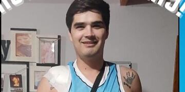 Daniel Ezcurra fue operado con éxito