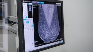 La realización de los chequeos anuales es clave para la detección precoz de la enfermedad. (Hospital Privado de Córdoba)