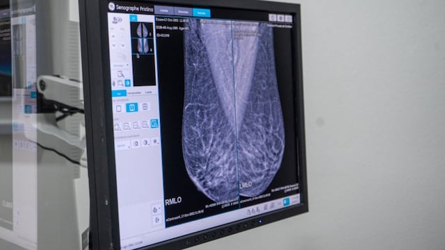 La realización de los chequeos anuales es clave para la detección precoz de la enfermedad. (Hospital Privado de Córdoba)