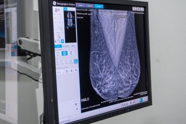 La realización de los chequeos anuales es clave para la detección precoz de la enfermedad. (Hospital Privado de Córdoba)