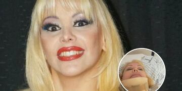 El desgarrador relato de Flavia Miller tras sufrir un terrible accidente de tránsito: “Volé por el aire”