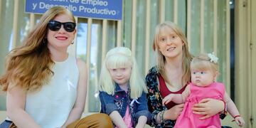 En la provincia hay una agrupación que nuclea a personas con albinismo y está a cargo de María Luz Ozollo