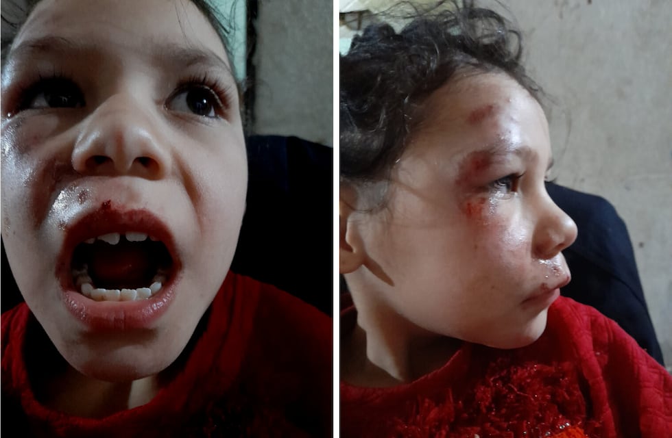 Buscan a un conductor que atropelló y dejó tirados a una nena y a su primo en Guaymallén