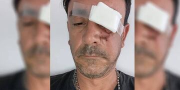 Mendocino fue atacado brutalmente por un limpiavidrios, ya condenado a dos años de prisión.
