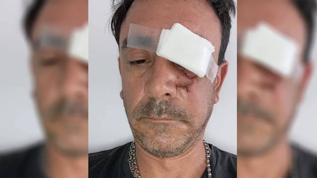 Mendocino fue atacado brutalmente por un limpiavidrios, ya condenado a dos años de prisión.