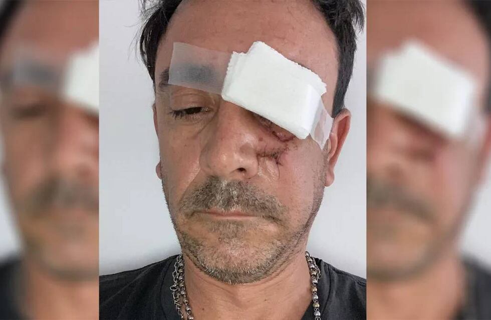 Prisión para el “limpiavidrios” que desfiguró a un conductor en Mendoza
