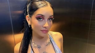 María Becerra confesó que se operó