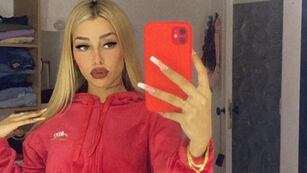 Tamara Báez volverá a retocar su rostro que está cada día más cambiado (Instagram).