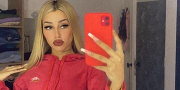 Tamara Báez volverá a retocar su rostro que está cada día más cambiado (Instagram).