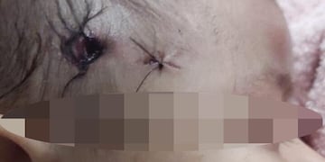 La nena fue operada de urgencia