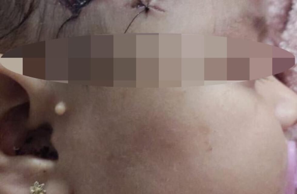 Una bebé de cinco meses recibió un disparo en la cabeza durante una persecución policial