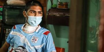 Blas Díaz, capitán de Alianza, tras el accidente en moto que casi le cuesta la vida.