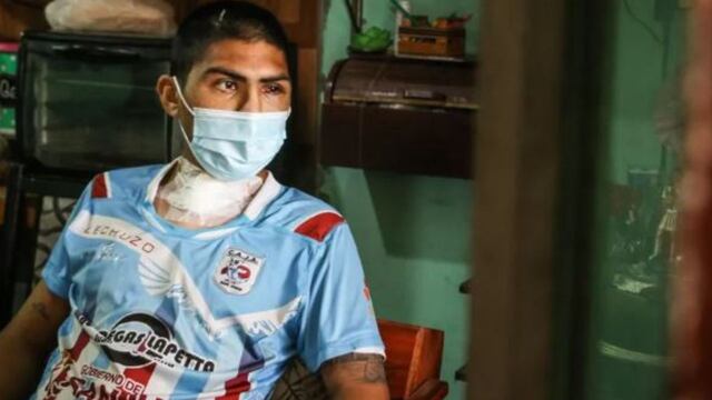 Blas Díaz, capitán de Alianza, tras el accidente en moto que casi le cuesta la vida.