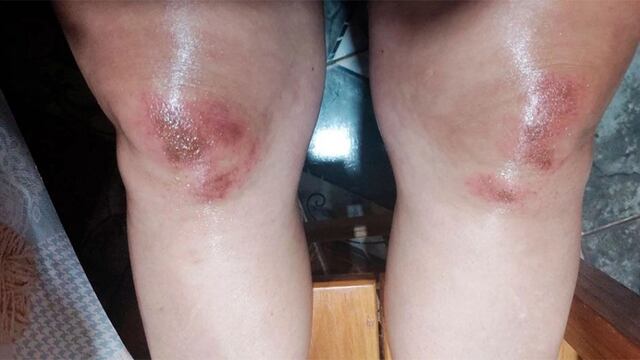 Oberá: estaba preso por violencia de género, salió y volvió a atacar a su ex pareja.