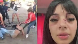 La reconocieron de TikTok y la atacaron a golpes “por ser linda” a la salida de un boliche: “Me desmayé”