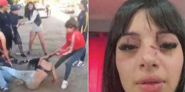 La reconocieron de TikTok y la atacaron a golpes “por ser linda” a la salida de un boliche: “Me desmayé”