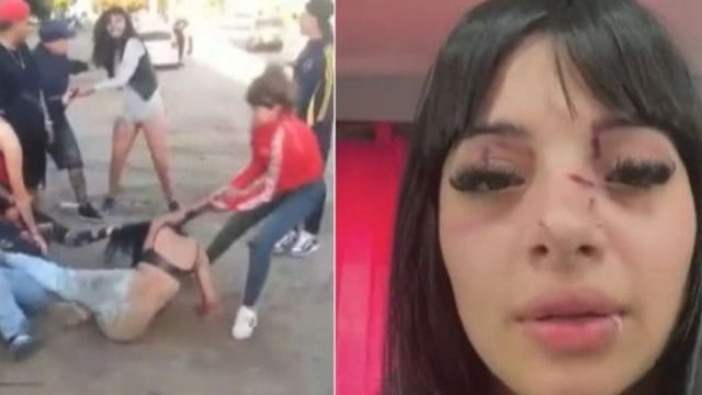 La reconocieron de TikTok y la atacaron a golpes “por ser linda” a la salida de un boliche: “Me desmayé”