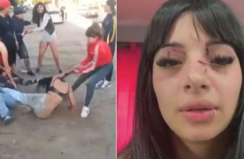 La reconocieron de TikTok y la atacaron a golpes “por ser linda” a la salida de un boliche: “Me desmayé”