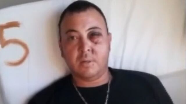 El hincha de Gimnasia que podría perder un ojo