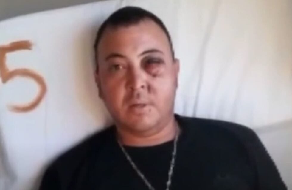 Un hincha de Gimnasia podría perder un ojo tras la represión policial: “Hoy ya no veo”