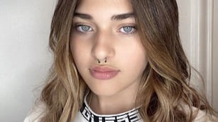 El desgarrador relato de Marta Fort sobre su estado de salud: “Tengo afectada la motricidad y la movilidad de la mitad de mi cuerpo”.