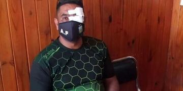 Farías es el árbitro que fue agredido por un adulto en un partido Sub 17, en Cruz del Eje.