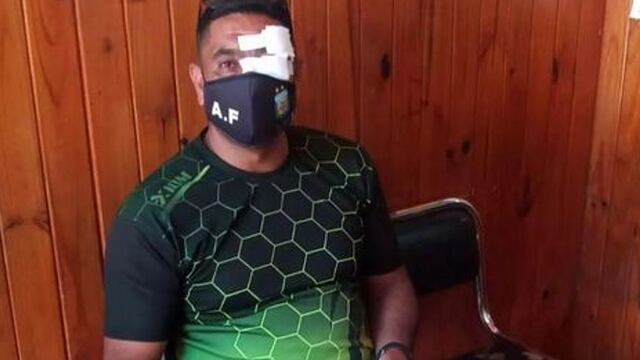 Farías es el árbitro que fue agredido por un adulto en un partido Sub 17, en Cruz del Eje.