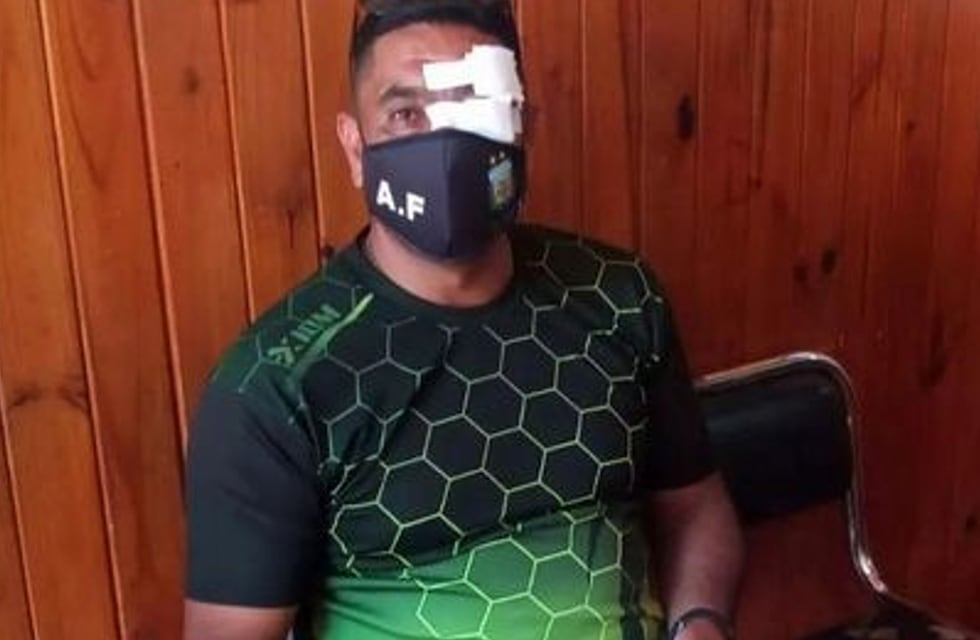 Cruz del Eje: salvaje ataque a un árbitro en partido juvenil