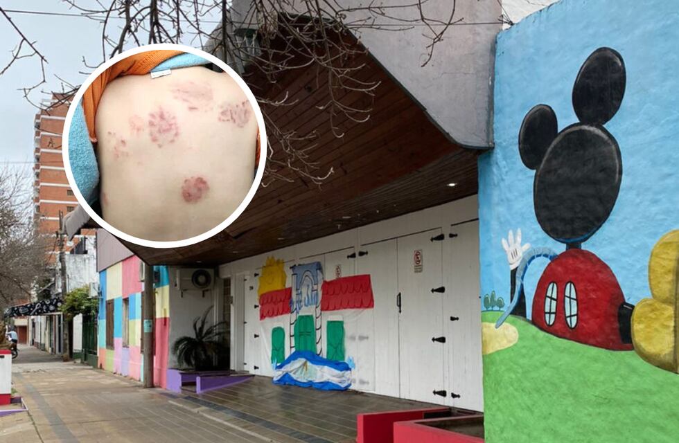 Indignación en Chaco: una familia denunció que su hijo de 2 años volvió del jardín con lesiones y mordeduras