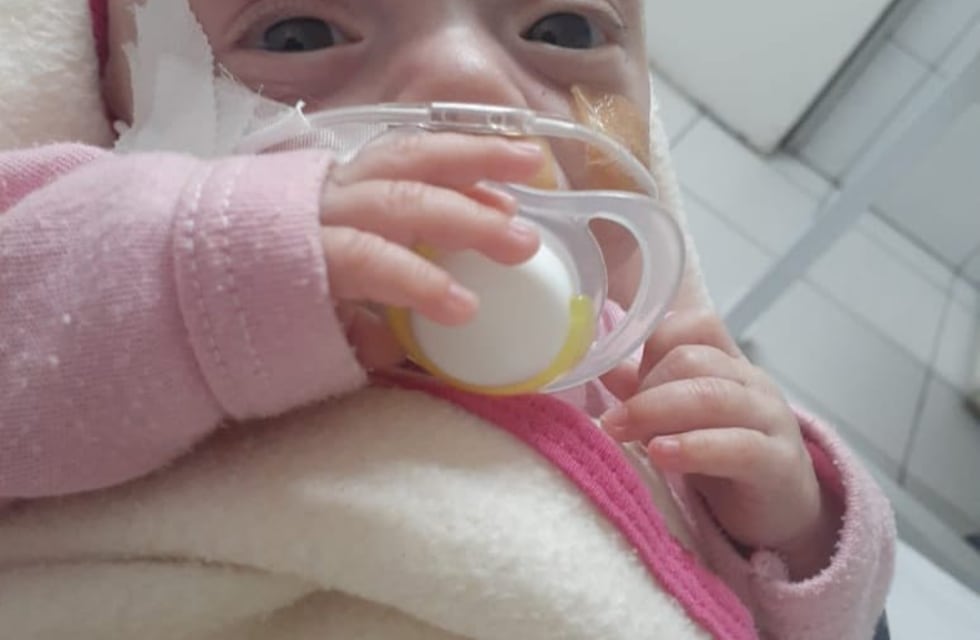 “Todos por Guadalupe”, la campaña que busca ayudar a una bebé con displasia broncopulmonar