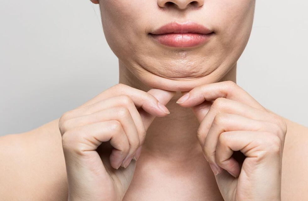 Cuál es la sustancia que sirve para reducir la papada de forma casera, según los expertos