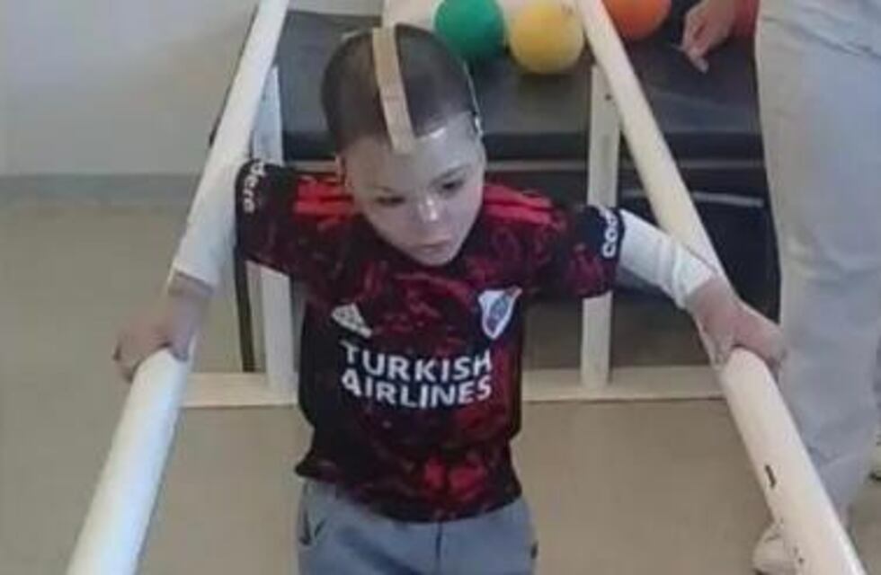 Cuando tenía 3 años, una explosión le quemó el 60% de su cuerpo: 6 meses después volvió a caminar y continúa su recuperación