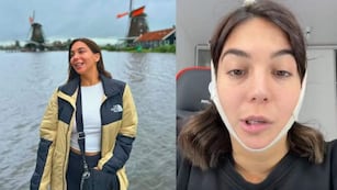 La influencer que tuvo una parálisis facial tras hacerse una liposucción.