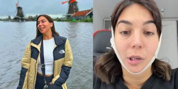 La influencer que tuvo una parálisis facial tras hacerse una liposucción.