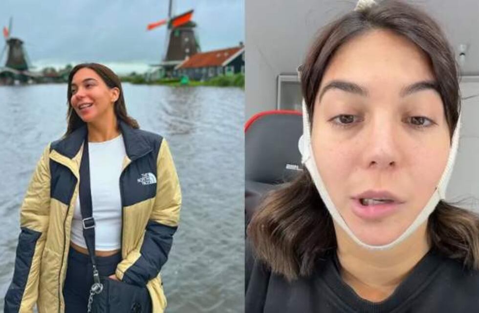 Preocupación por la salud de la influencer chaqueña Luciana Milessi: sufrió una parálisis facial tras hacerse una operación estética