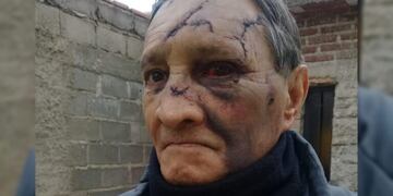 Alberto García, víctima de violento robo en Villa Mercedes.