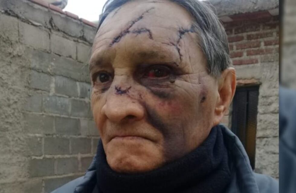 Villa Mercedes: lo golpearon con un martillo en la cabeza para robarle